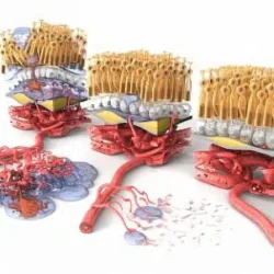 Photodynamic Laser Therapy